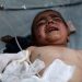 Afganistan’daki bombalı saldırıda 3 kişi öldü