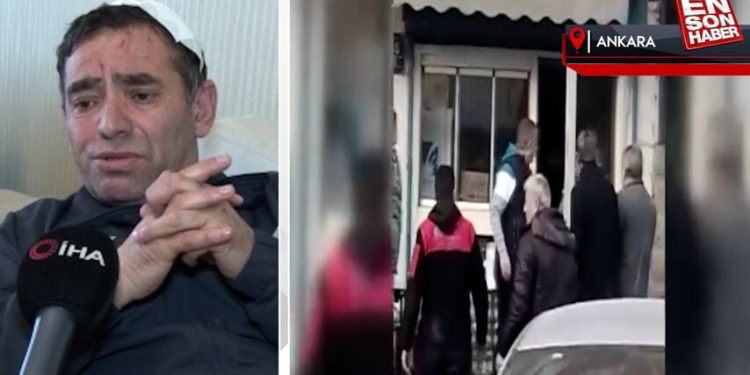 Ankara’da miras araba için amcasının kafa derisini yüzdü